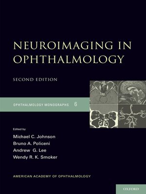 cover image of Neuroimaging in Ophthalmology